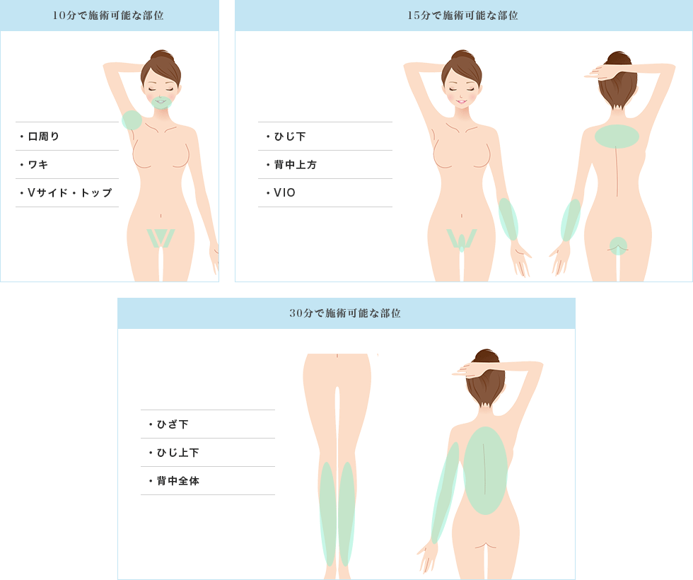 施術時間の目安